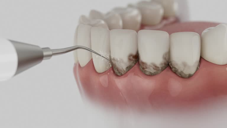 Reliable Tooth Extraction contractor in St. Charles Parish County, LA by Dentist Open Now